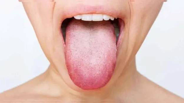 Oral Cancer Causes : స్మోకింగ్ చేయకపోయినా నోటి క్యాన్సర్ ముప్పు! ఎందుకో తెలుసా..?   