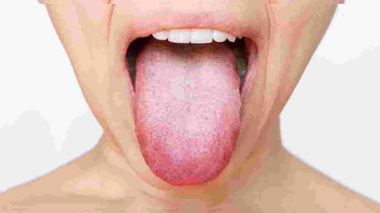 Oral Cancer Causes : స్మోకింగ్ చేయకపోయినా నోటి క్యాన్సర్ ముప్పు! ఎందుకో తెలుసా..?   