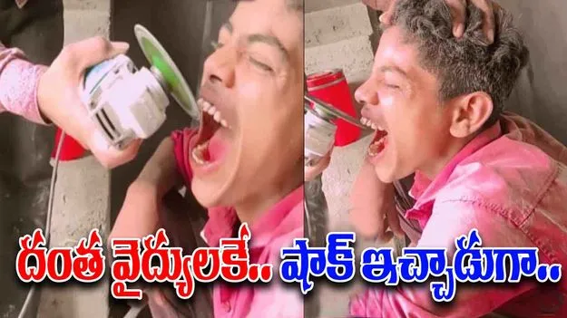 Funny Viral Video: విరిగిన దంతాన్ని ఇలా సరిచేయవచ్చని ఇప్పుడే తెలిసింది.. ఇతను చేసిన పని చూస్తే.. 