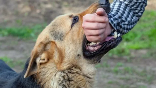 Dog Bite Infection:  కుక్క కరిస్తే ఎన్ని గంటల్లోపు ఇంజెక్షన్ ఇవ్వాలో తెలుసా?