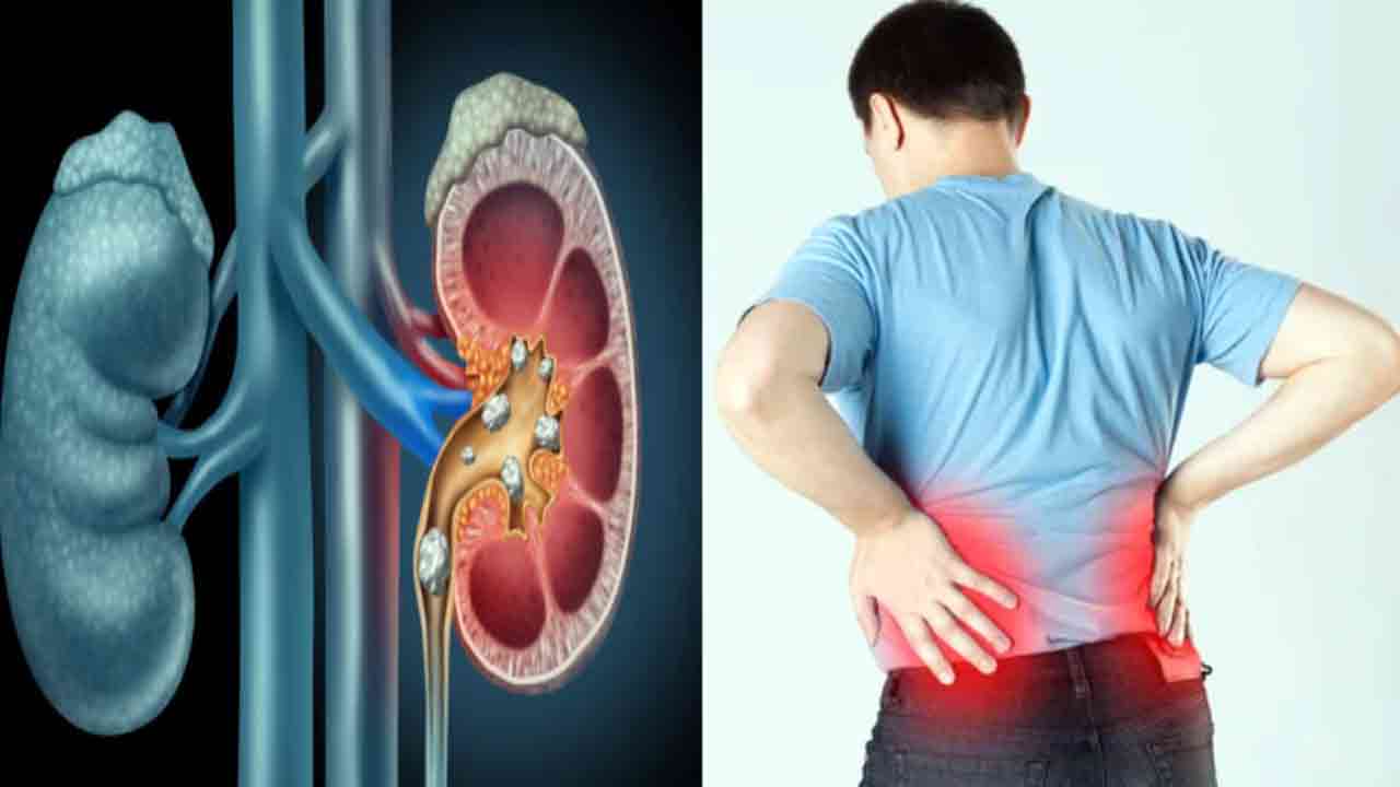 Health Tips: ఈ 5 ప్రదేశాల్లో నొప్పిగా ఉందా.. అయితే మీ కిడ్నీలు జాగ్రత్త..  
