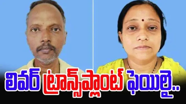 Wifes Live Liver Donation: భర్తకు ప్రాణం పోద్దామనుకుంది.. పాపం తను కూడా..