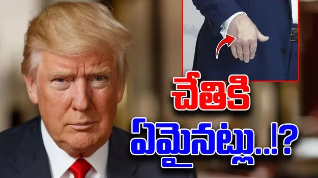 Trump Hand Bruise: ట్రంప్ చేతిపై మళ్లీ ఎర్రని మచ్చ.. అసలేం జరుగుతోంది