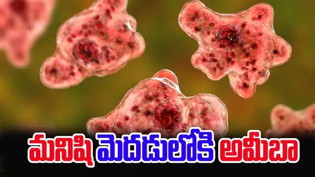 Rare Brain Eating Amoeba: మనిషి మెదడులోకి ప్రవేశించిన అమీబా.. అక్కడి మాంసం తినేసి..