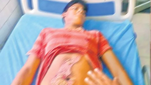 Assault on Student: దాడి చేసి.. ఇస్త్రీ పెట్టెతో వాతలు పెట్టి