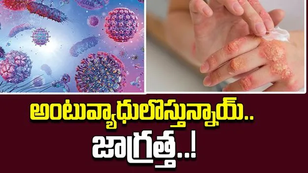 Continuous Rains: అంటువ్యాధులొస్తున్నాయ్‌.. జాగ్రత్త!