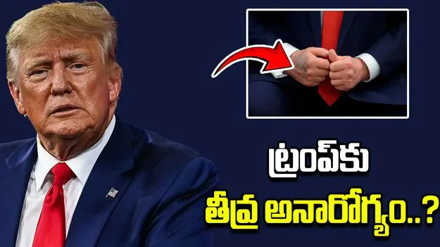Donald Trump Health: ట్రంప్‌ ఆరోగ్యంపై ఆందోళన