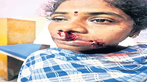 అనకాపల్లిలో వీధి కుక్కల బెడద