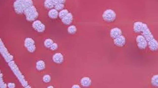 Turkapalem Fever Mystery Solved: తురకపాలెం మిస్టరీ వీడుతోంది