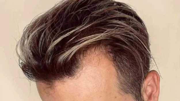 Hair Care Tips: స్వీట్లు ఎక్కువగా తినడం వల్ల జుట్టు మీద ప్రభావం ఉంటుందా?