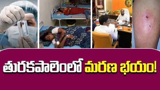 Turakapalem : పల్నాడు జిల్లా తురకపాలెంలో ఏం జరుగుతోంది? నేడు ఐసీఏఆర్ బృందం పర్యటన