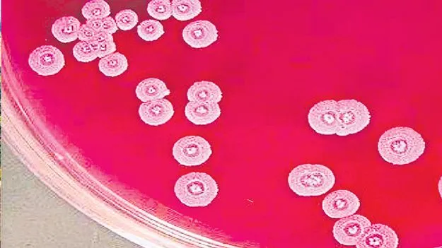 Guntur: అవి మెలియోయిడోసిస్‌ జ్వరాలు