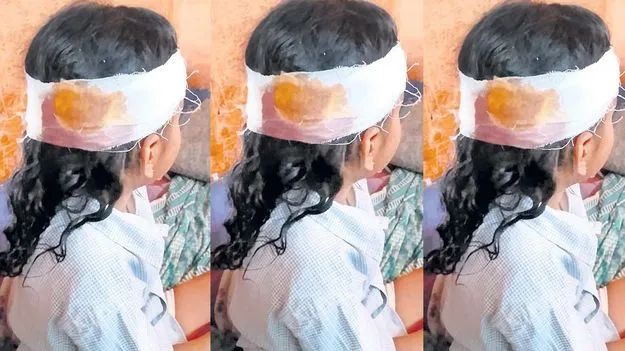 School Ceiling Collapse: నాణ్యత లేని నాడు నేడు పనులు