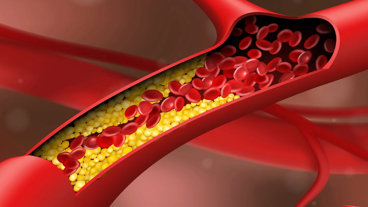 Cleanse Arteries: ధమనులను శుభ్రపరిచి రక్తప్రసరణను మెరుగుపరిచే ఫుడ్స్