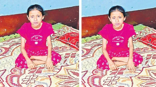 Rare Disease: పేదింటి చిన్నారికి అరుదైన వ్యాధి