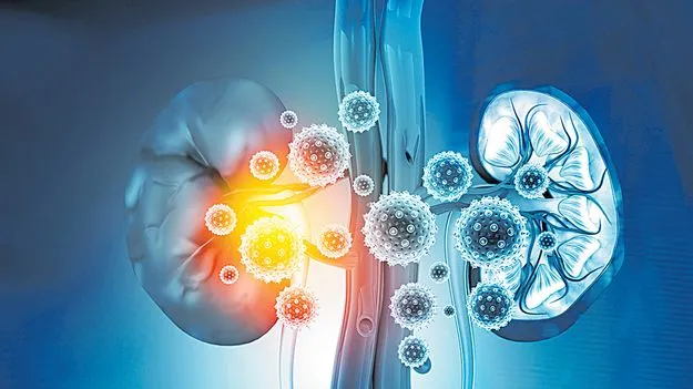 Kidney and Cancer Cases: బాబోయ్‌.. కిడ్నీ, క్యాన్సర్‌!