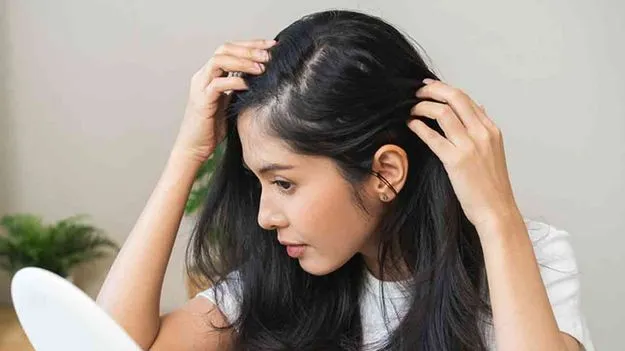 Home Remedies for Dandruff: చుండ్రు చికాకు పెడుతోందా
