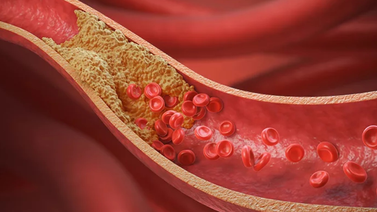 Cleanse Arteries: ధమనులను శుభ్రపరిచి రక్తప్రసరణను మెరుగుపరిచే ఫుడ్స్