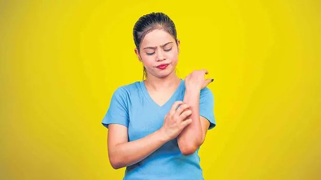 Effective Treatment for Psoriasis: సోరియాసిస్‌కు సమర్థమైన వైద్యం