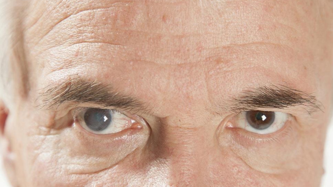 Cataract: వయసు పెరుగుతోందా? క్యాటరాక్ట్ ముప్పును తగ్గించుకోవాలంటే.. 