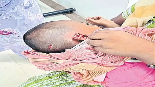 పిచ్చికుక్క స్వైరవిహారం