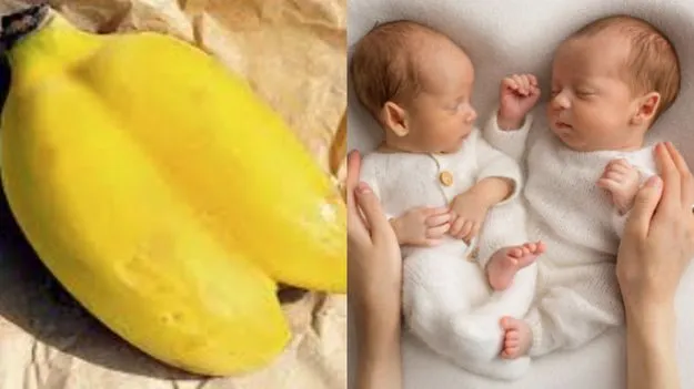 Twin Pregnancy Facts: జంట అరటి పండ్లు తింటే కవలలు పుడతారా.. ఇది నిజమేనా?
