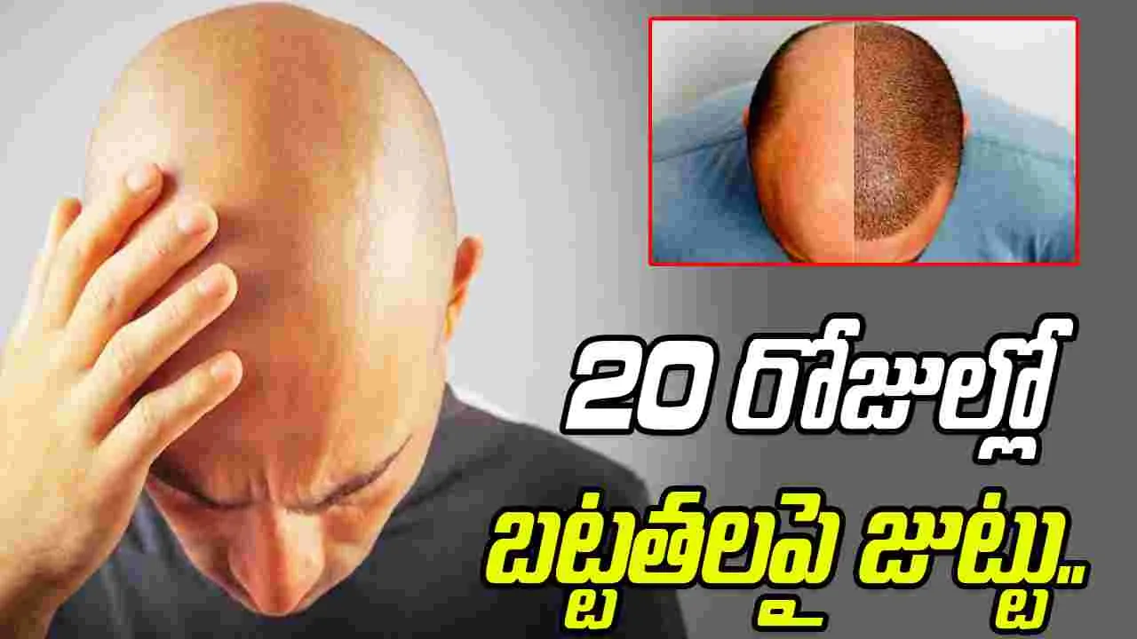 Hair Regrow Serum: బట్టతల ఉన్న వారికి శుభవార్త.. ఈ సీరమ్ 20 రోజుల్లో జుట్టు మొలిపిస్తుంది..