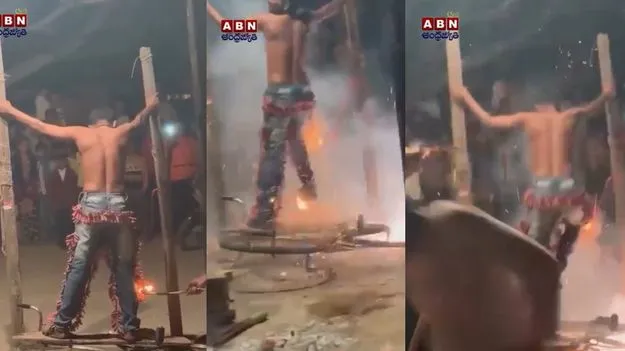 Diwali Stunt Viral Video: దీపావళి నాడు దారుణం.. నడుముకు 1000 వాలాను చుట్టుకుని వెలిగించడంతో..