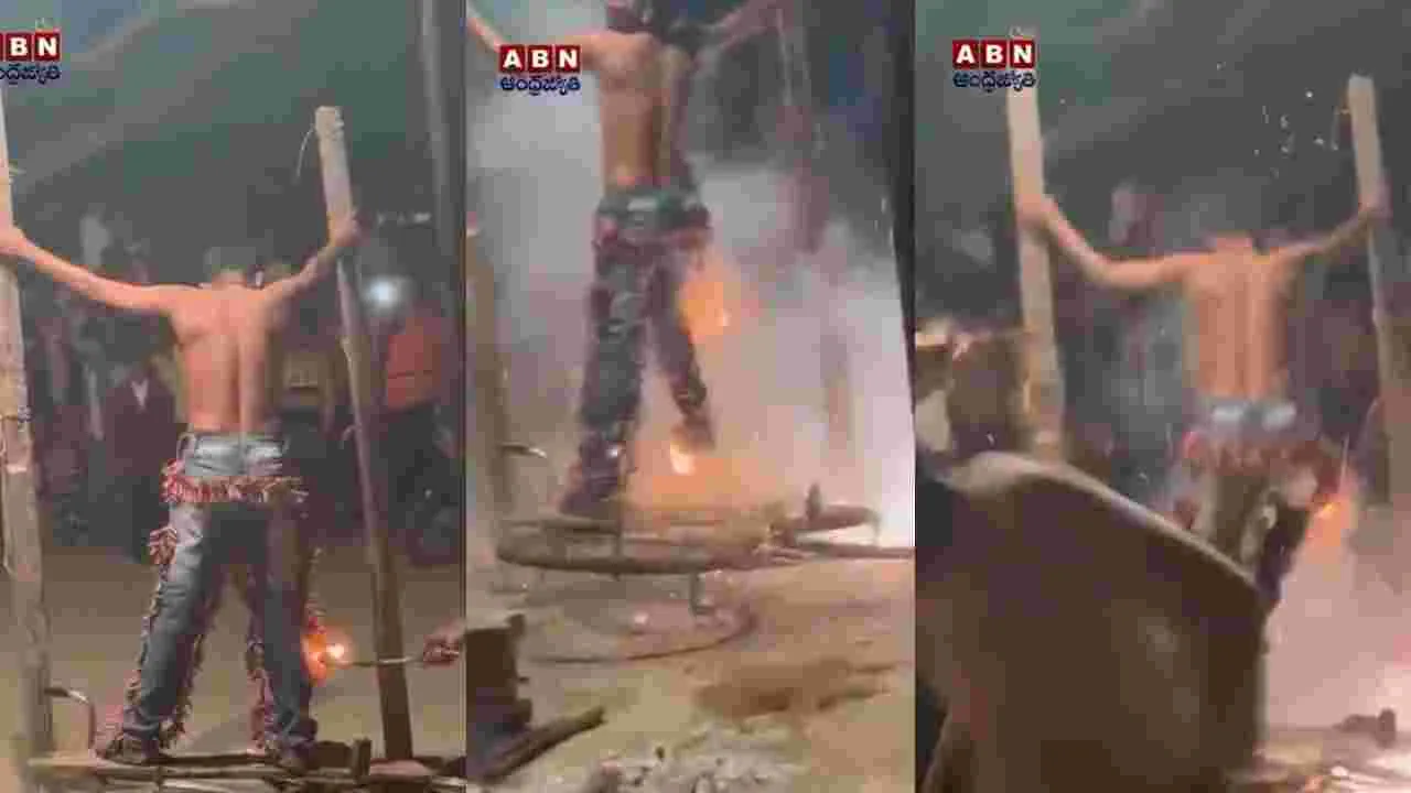 Diwali Stunt Viral Video: దీపావళి నాడు దారుణం.. నడుముకు 1000 వాలాను చుట్టుకుని వెలిగించడంతో..