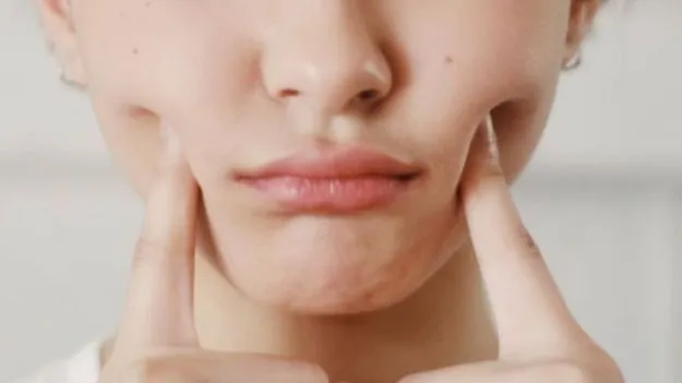 Morning Face Puffiness: ఉదయం నిద్రలేవగానే ముఖం వాపుగా ఉంటుందా? ఈ కారణాలు తెలుసుకోండి.!