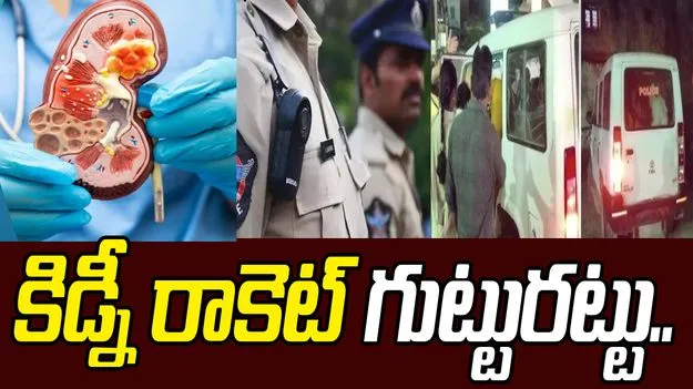 Kidney Racket: ఏపీలో కిడ్నీ రాకెట్ ముఠా గుట్టురట్టు.. సంచలన విషయాలు వెలుగులోకి... 