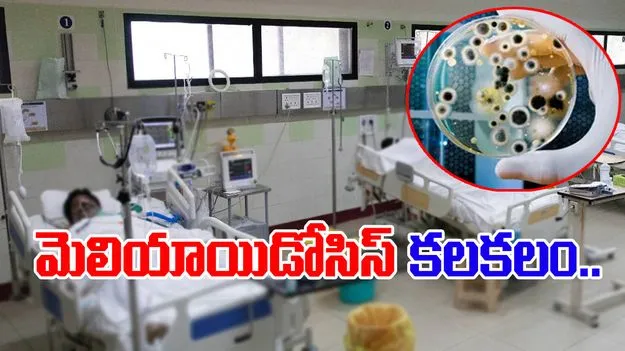 Palnadu Melioidosis Case: పల్నాడులో మెలియాయిడోసిస్‌ కలకలం.. 