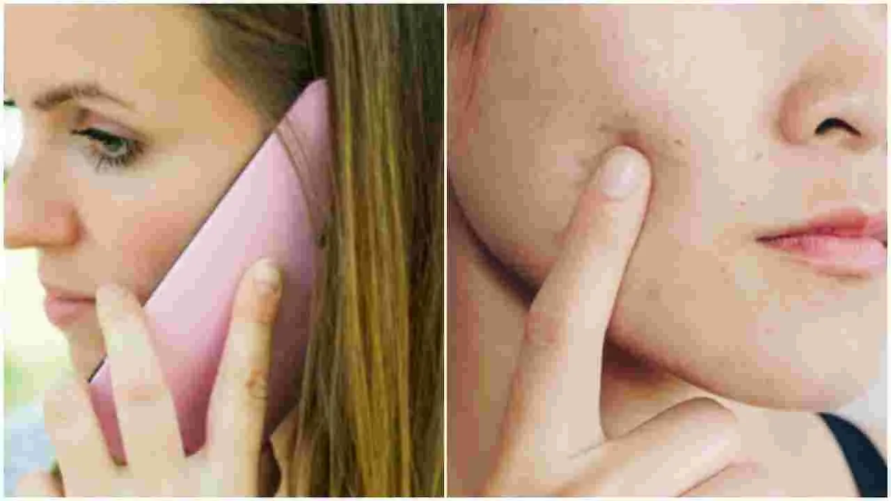 Can Phone Cause Pimples: ఎక్కువ సేపు ఫోన్‌లో మాట్లాడటం వల్ల ముఖంపై మొటిమలు వస్తాయా?