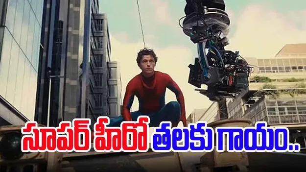 Tom Holland Hospitalised: స్పైడర్ మ్యాన్ షూటింగ్‌లో ప్రమాదం.. హీరో తలకు గాయం..