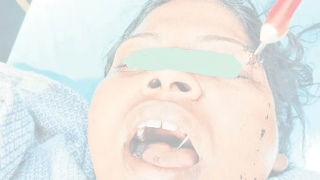 Gannavaram: బాణసంచా వివాదంలో.. భార్యను పొడిచేశాడు