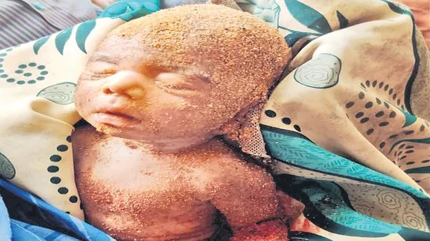 Infant Loss: ఎందుకమ్మా ఇంత నిర్దయ
