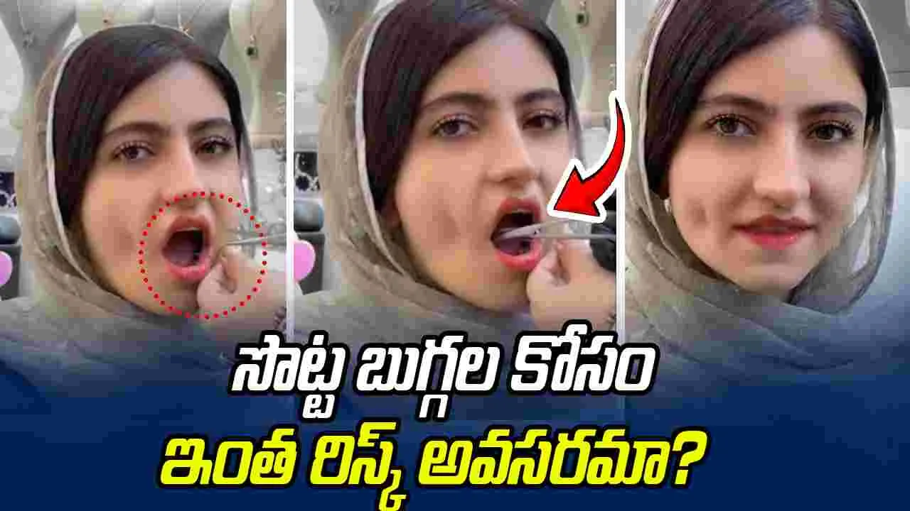 Viral beauty trend: సొట్ట బుగ్గల కోసం ఇంత రిస్క్ అవసరమా? ఈ అమ్మాయి ఏం చేసిందో చూడండి..