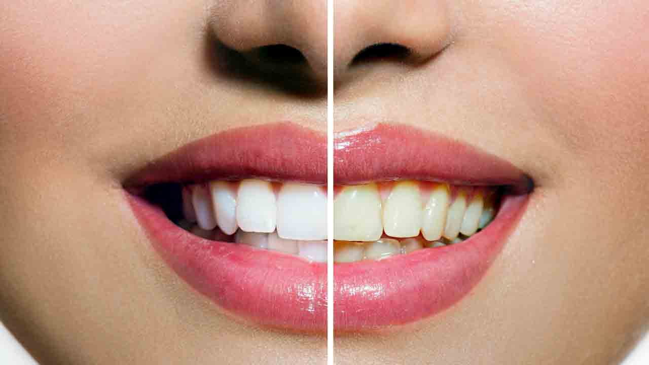 Health Tips: బ్రష్ చేసిన వెంటనే టీ తాగుతున్నారా.. అయితే జరిగేది ఇదే.. 