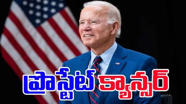 Biden prostate cancer: జో బైడెన్‌కు ప్రొస్టేట్ క్యాన్సర్.. రేడియేషన్ థెరపీ పూర్తి..