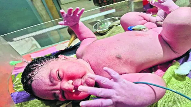Hyderabad: కింగ్‌కోఠి ఆస్పత్రిలో బాల భీముడు జననం