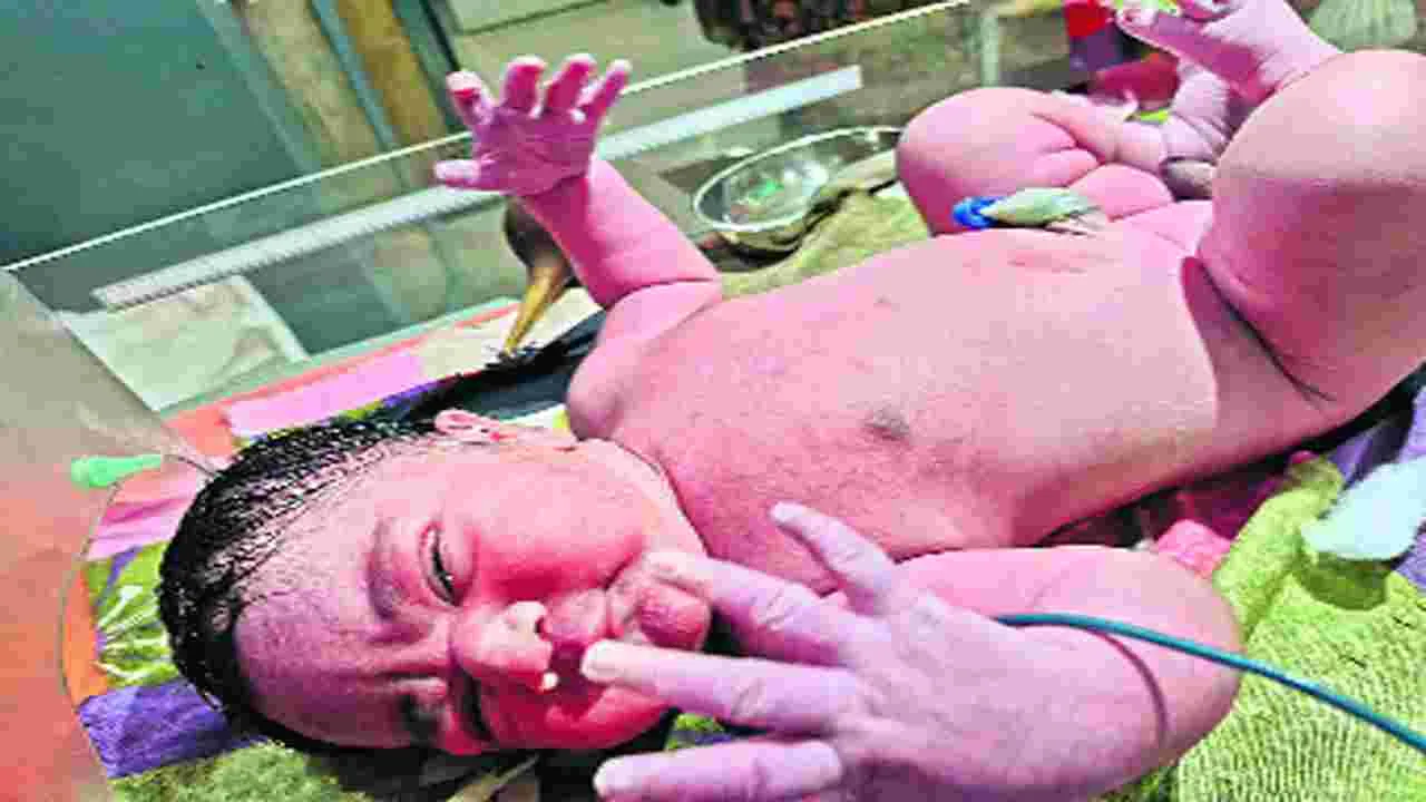 Hyderabad: కింగ్‌కోఠి ఆస్పత్రిలో బాల భీముడు జననం