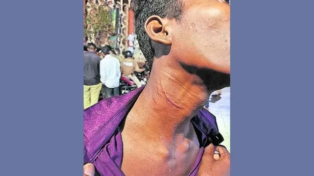 Hyderabad: కుక్కను బెదిరించాడని.. బాలుడిపై తండ్రీకొడుకుల దాడి 