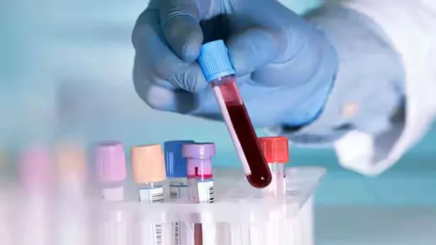 Health: క్షణాల్లో బ్లడ్‌ రిపోర్ట్స్‌.. అందుబాటులోకి హెల్త్‌ ఏటీఎంలు