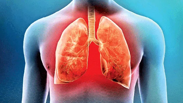 న్యుమోనియాతో జాగ్రత్త