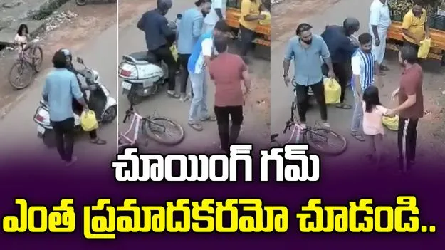 chewing gum accident: మీ పిల్లలు చూయింగ్ గమ్ తింటున్నారా? ఈ వీడియో చూస్తే ఆశ్చర్యపోవాల్సిందే.. 