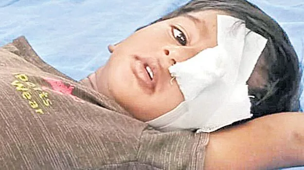 Dog Attack in Ranga Reddy District: వీధి కుక్కల దాడి.. చూపు కోల్పోయిన చిన్నారి 