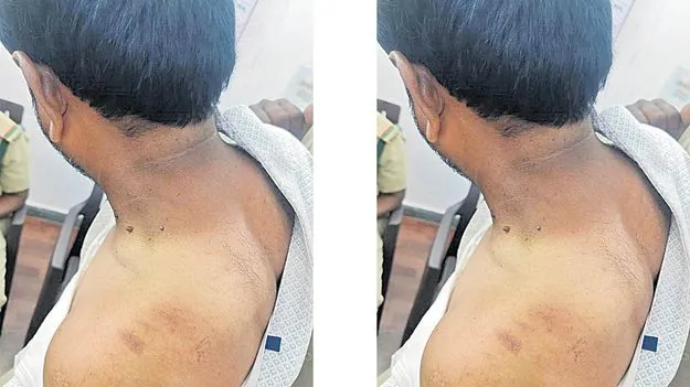 Tribal Attack on Forest Department: అటవీ శాఖ సిబ్బందిపై గిరిజనుల దాడి