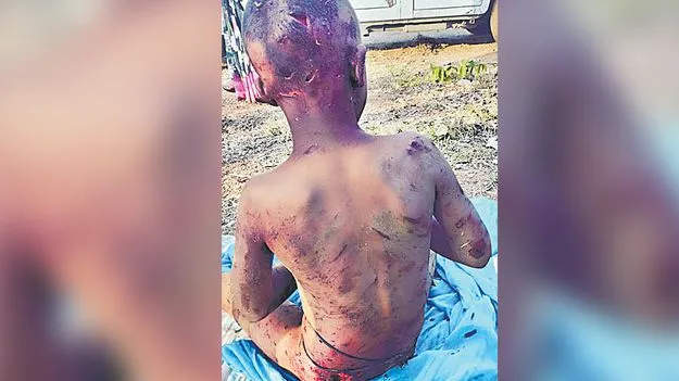 Animal Attack: పాపం పసివాడు