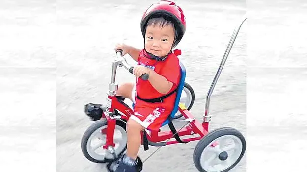 Stem Cell Treatment For Hunter Syndrome: జీన్‌ థెరపీకి తలవంచుతున్న అరుదైన వ్యాధి