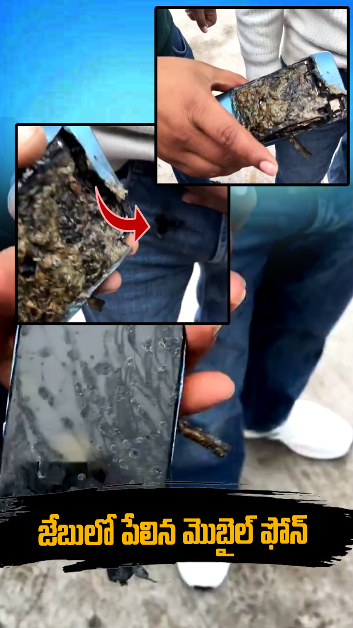 జేబులో పేలిన మొబైల్ ఫోన్